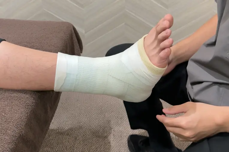 腓骨筋腱脱臼に対するギプス固定