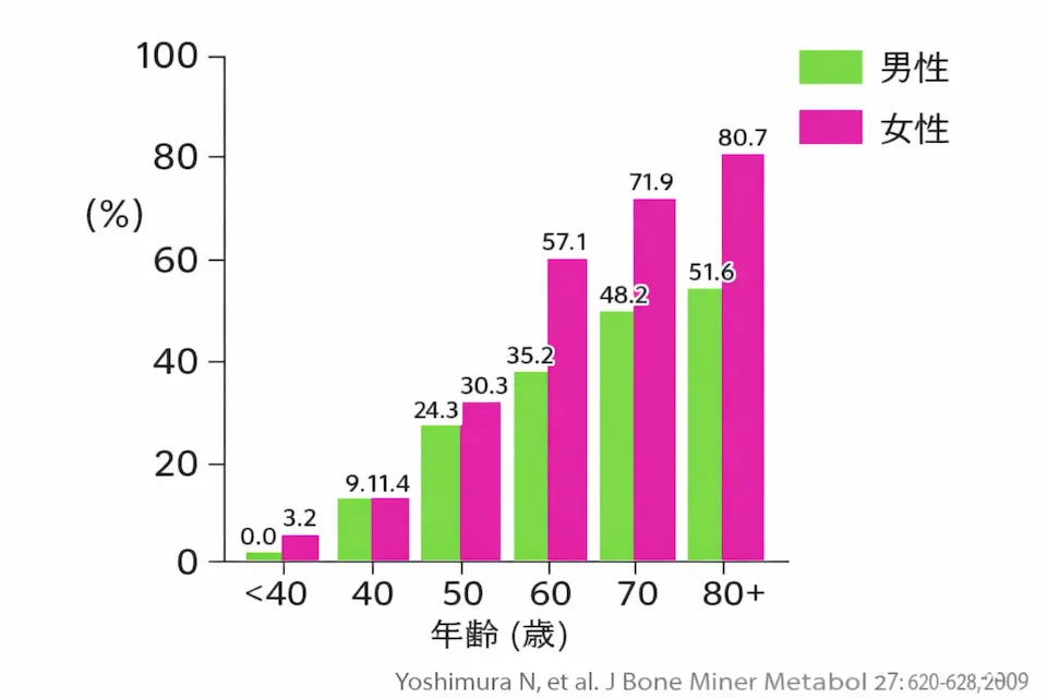 変形性膝関節症の疫学