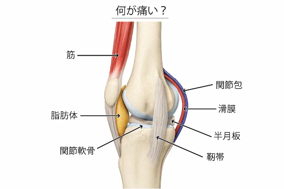 変形性膝関節症（何が痛い？）