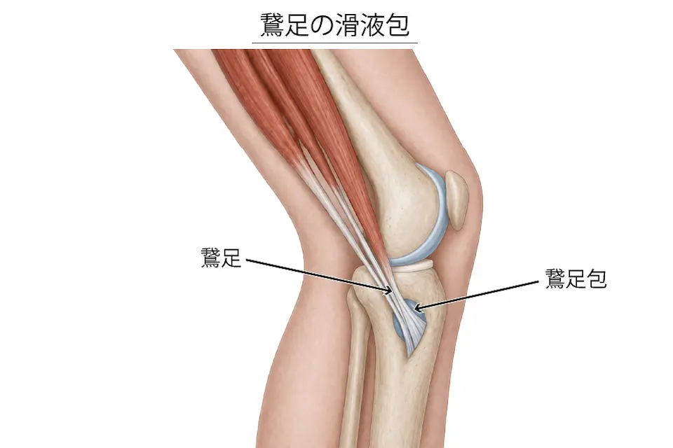 変形性膝関節症（鵞足包炎）