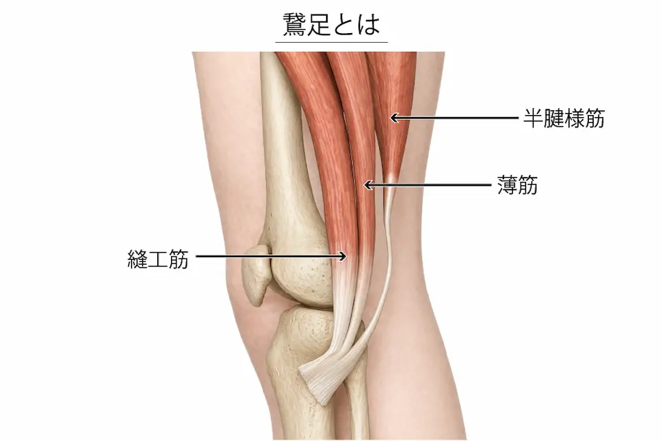 変形性膝関節症（鵞足）