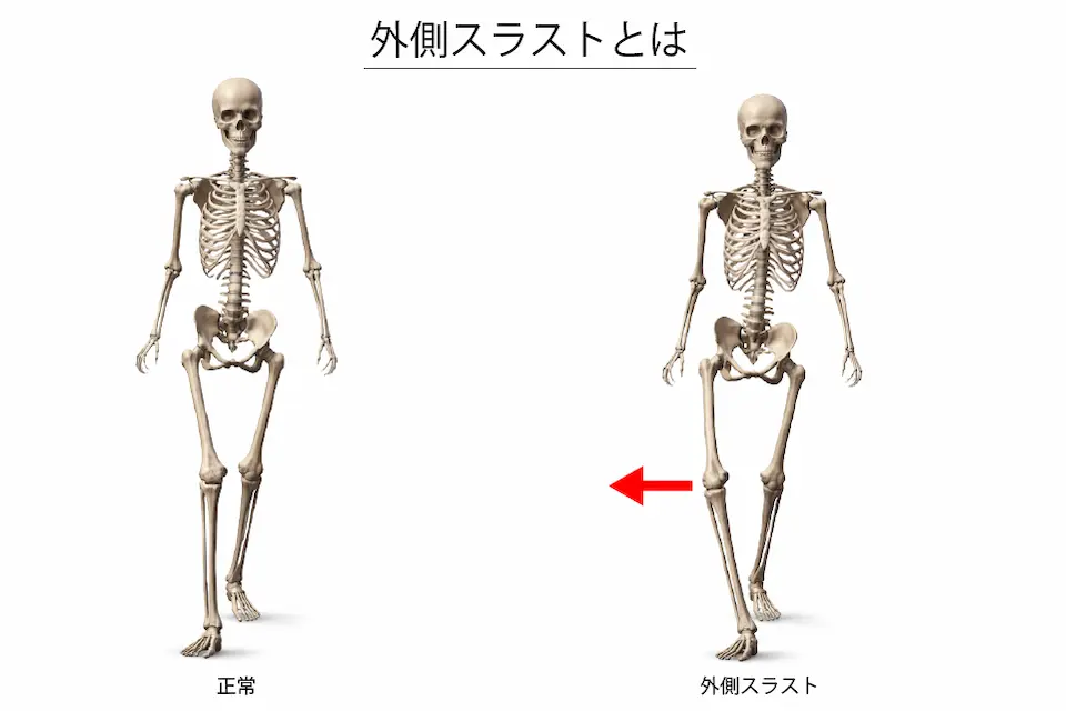 外側スラストとは