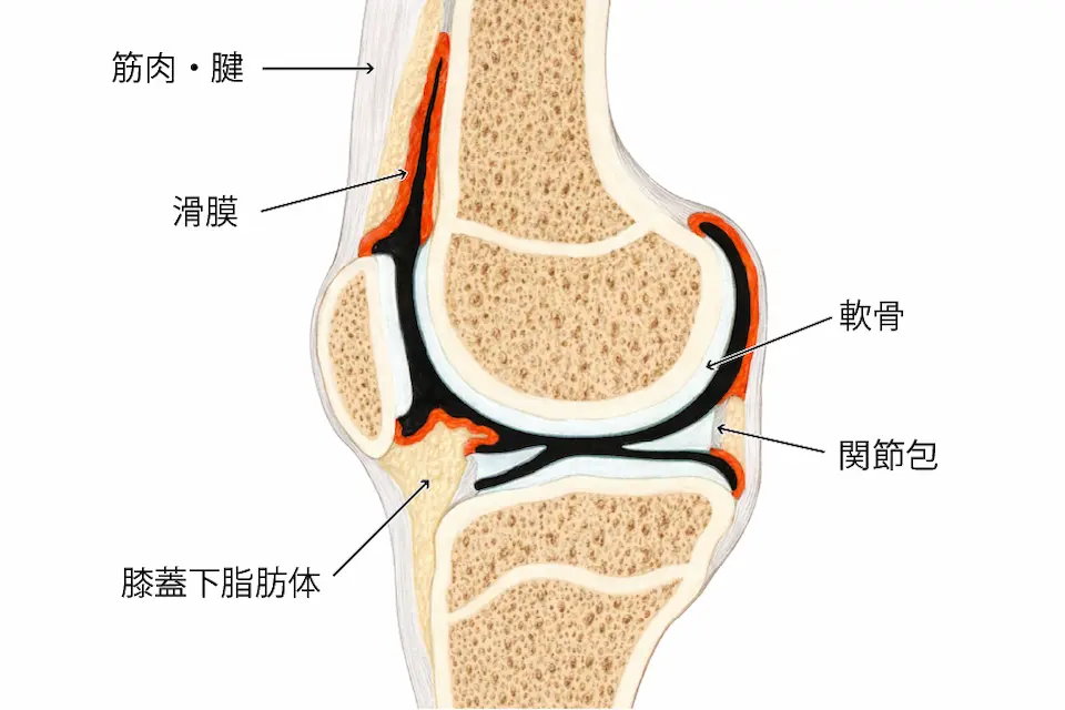 軟骨以外の痛みの原因