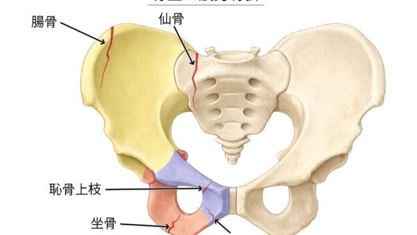 骨盤の疲労骨折｜超音波治療による早期回復サポート