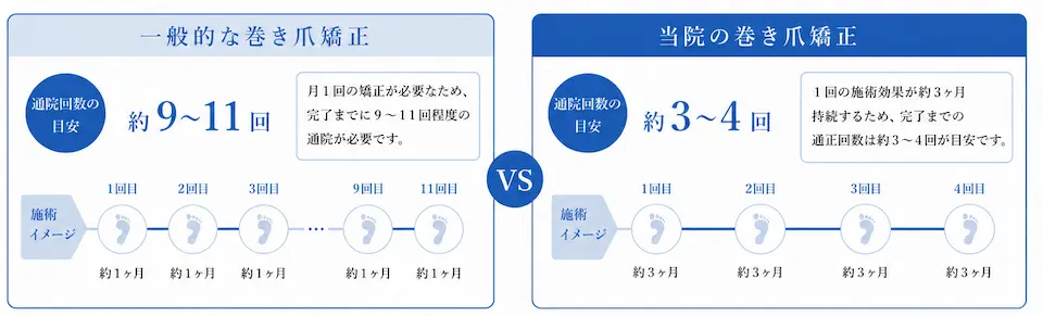 巻き爪矯正通院頻度