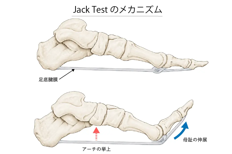 Jackテストのメカニズム