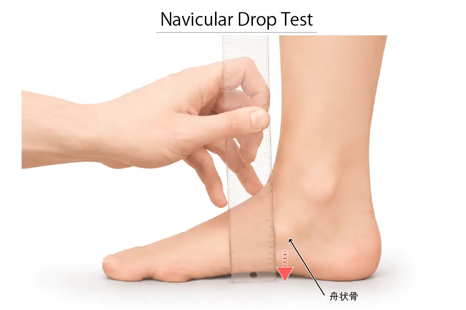 Navicular Drop Test