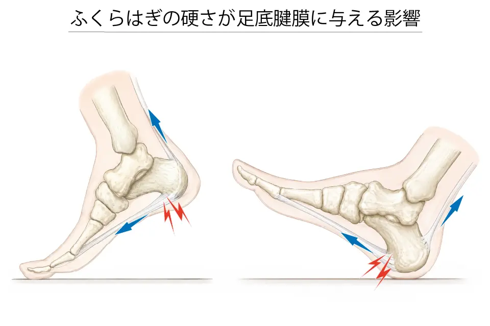 ふくらはぎの硬さが足底腱膜に与える影響