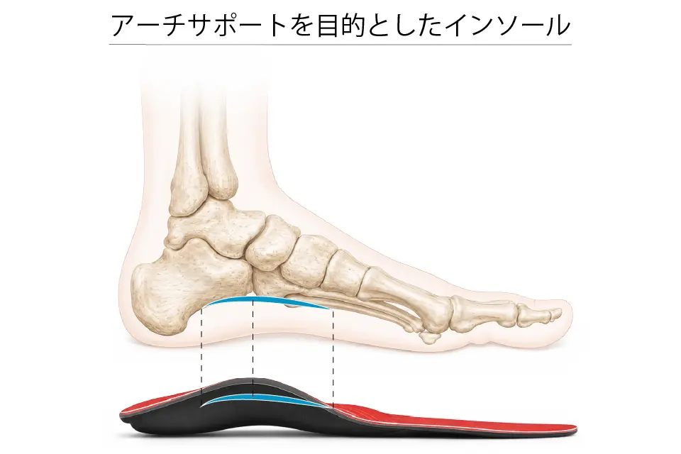 アーチサポートを目的としたインソール
