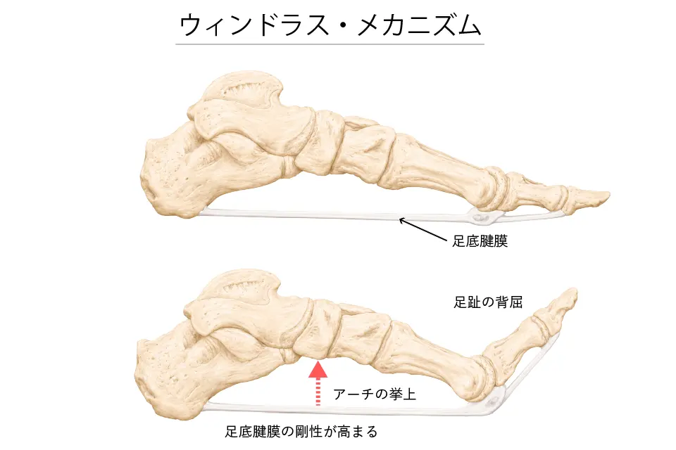 ウィンドラス・メカニズム