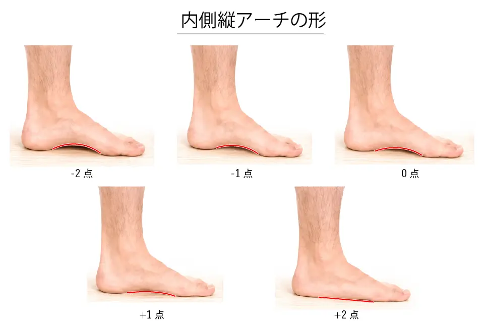 内側縦アーチの形