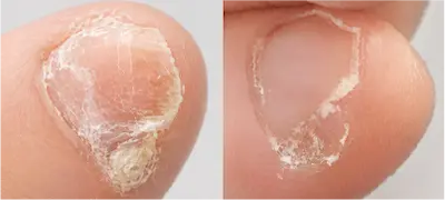 副爪２