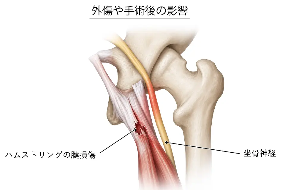外傷や手術後の影響