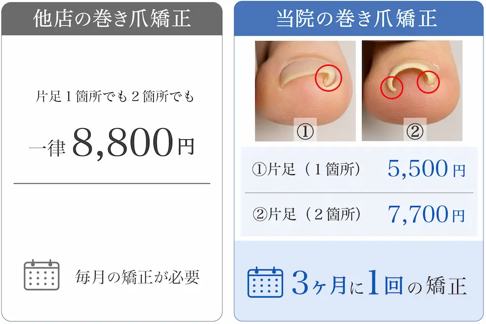 巻き爪矯正他店との費用比較