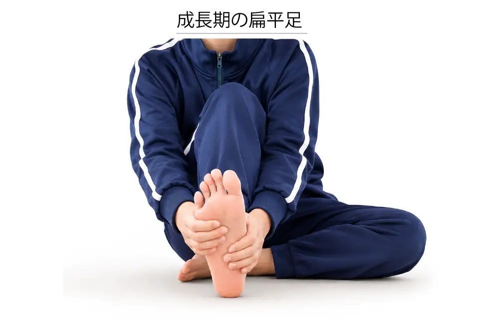成長期の扁平足