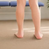 扁平足の人に多い歩き方とは？｜足部アーチ低下による動作の特徴を解説