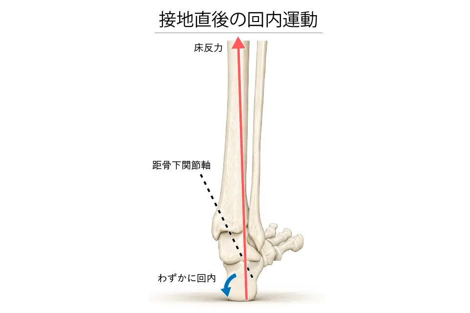 接地直後の回内運動