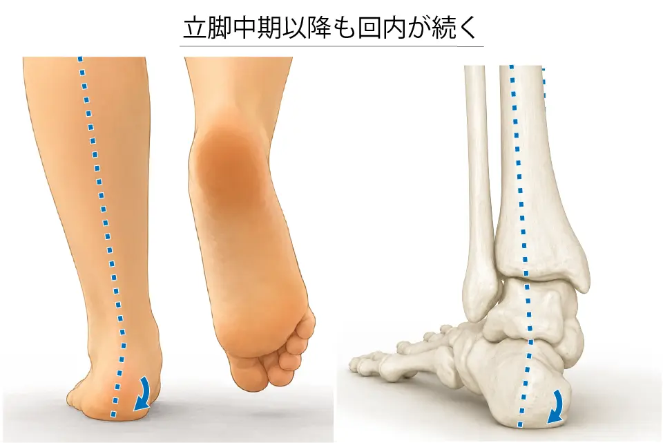 立脚中期以降も回内が続く