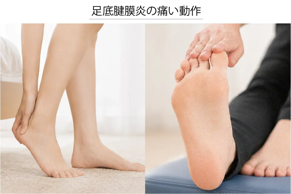 足底腱膜炎で痛い動作