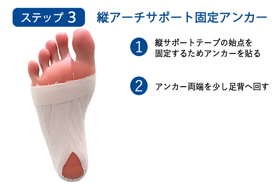 足底腱膜炎のテーピングステップ３