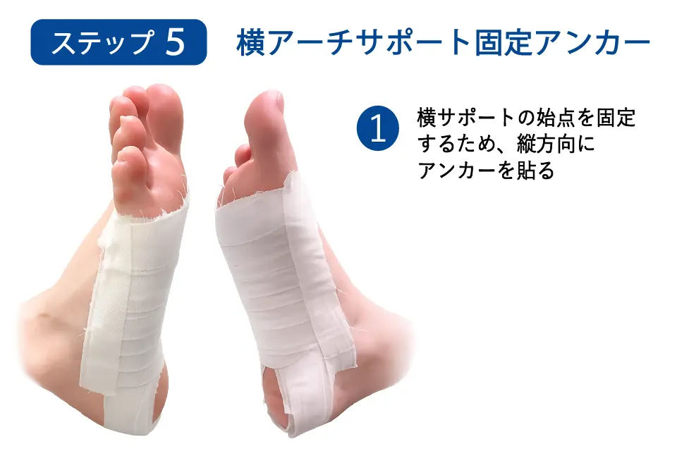 足底腱膜炎のテーピングステップ５