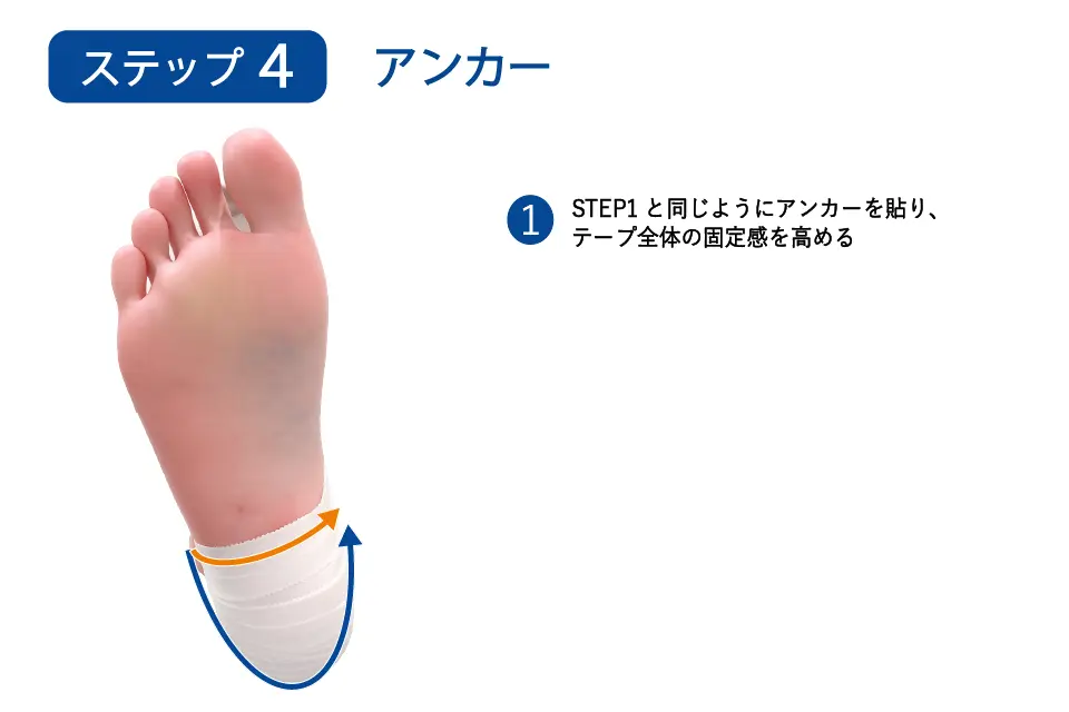 足底腱膜炎（ハイアーチ）のテーピングステップ4
