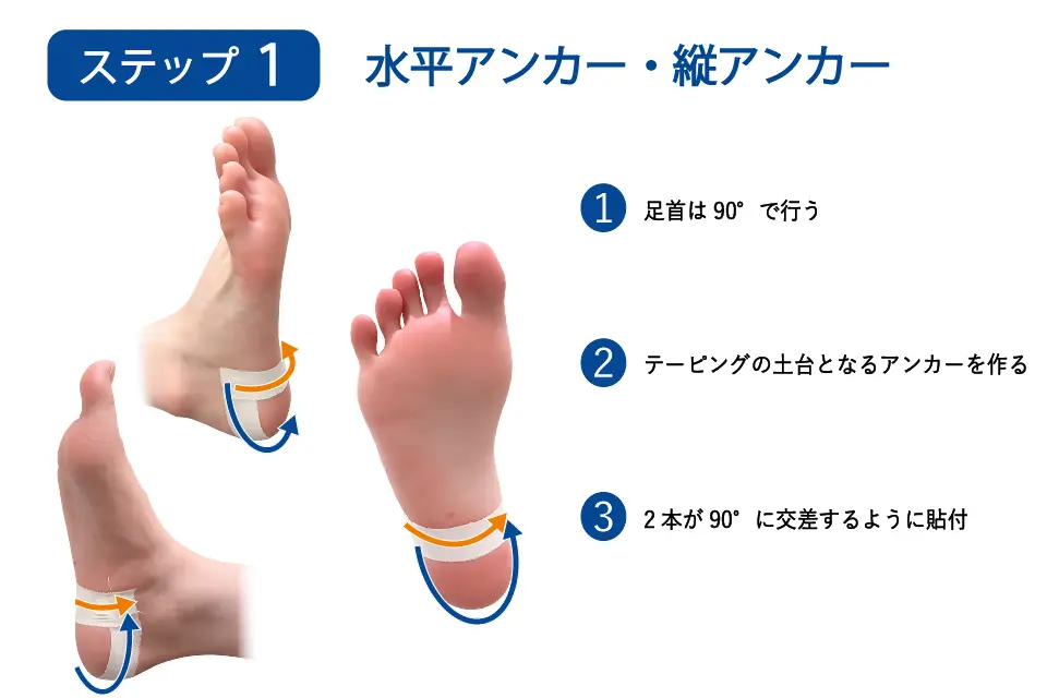 足底腱膜炎（ハイアーチ）のテーピングステップ１
