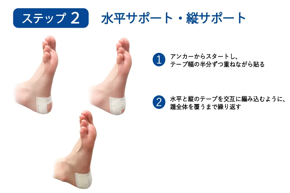 足底腱膜炎（ハイアーチ）のテーピングステップ２