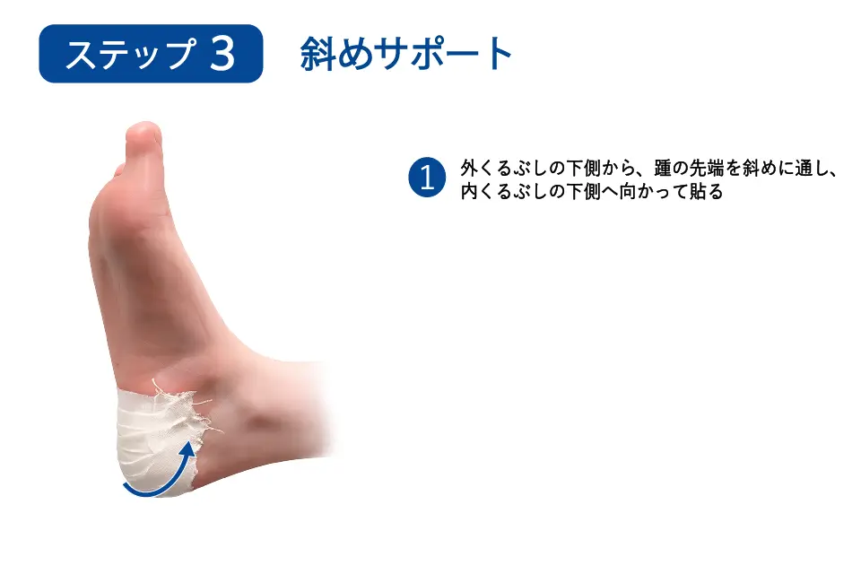 足底腱膜炎（ハイアーチ）のテーピングステップ３