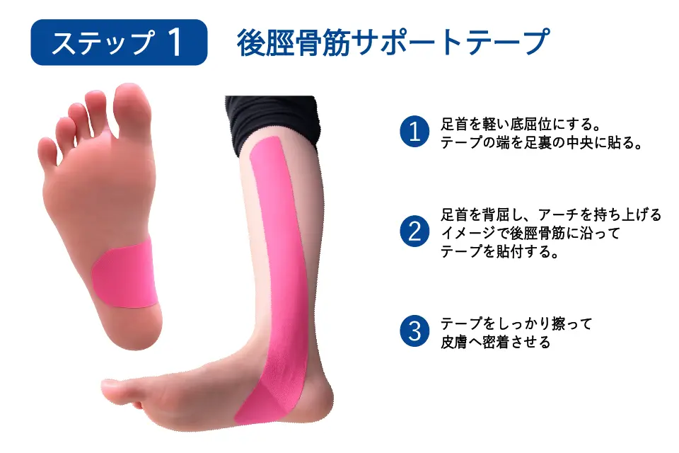 足底腱膜炎（回内足）のテーピングステップ１