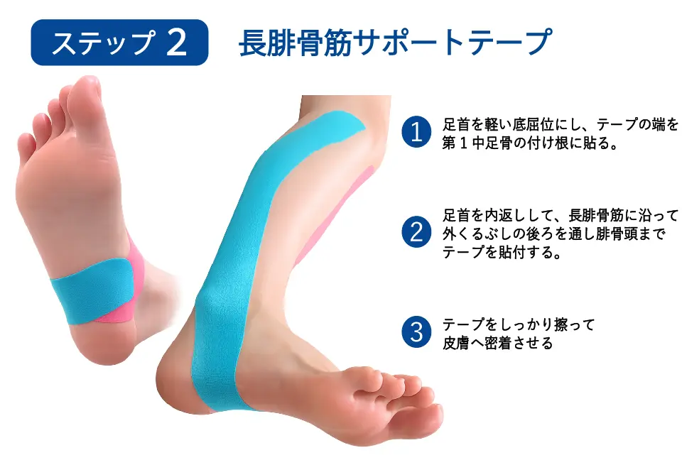 足底腱膜炎（回内足）のテーピングステップ２