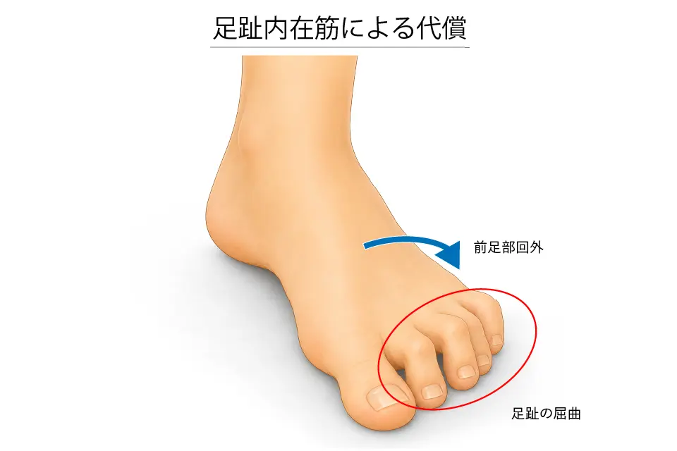 足趾内在筋による代償