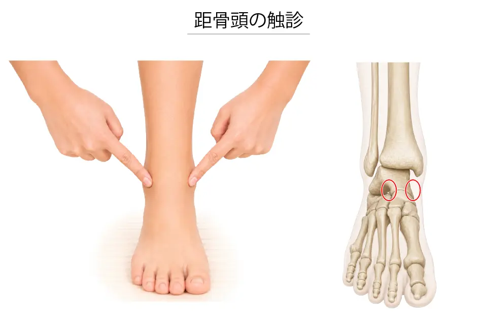 距骨頭の触診