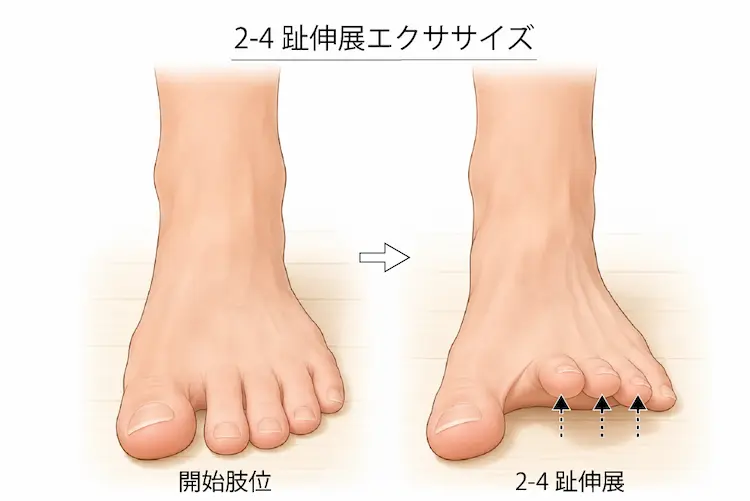 2-4趾伸展エクササイズ