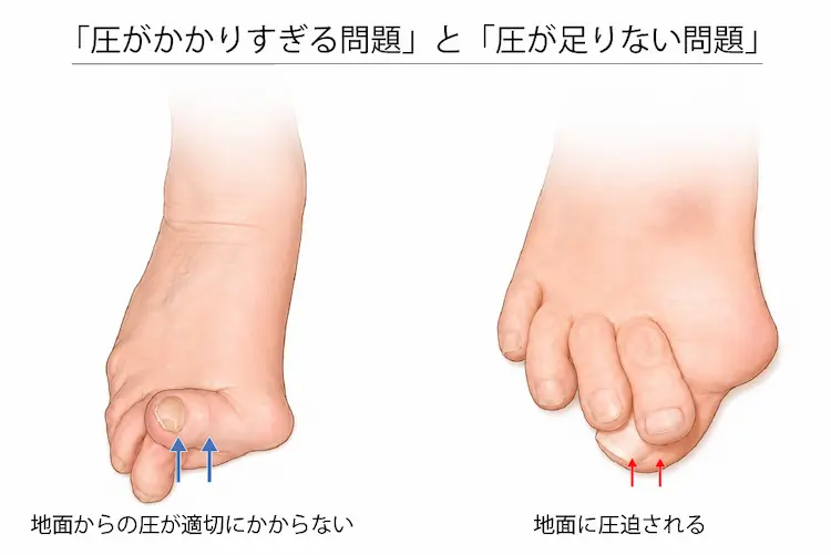 「圧がかかりすぎる問題」と「圧が足りない問題」