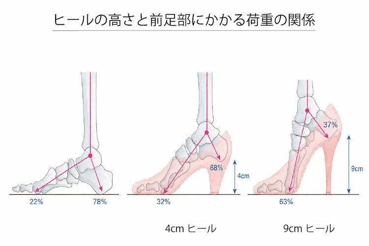 ヒールの高さと前足部にかかる荷重の関係