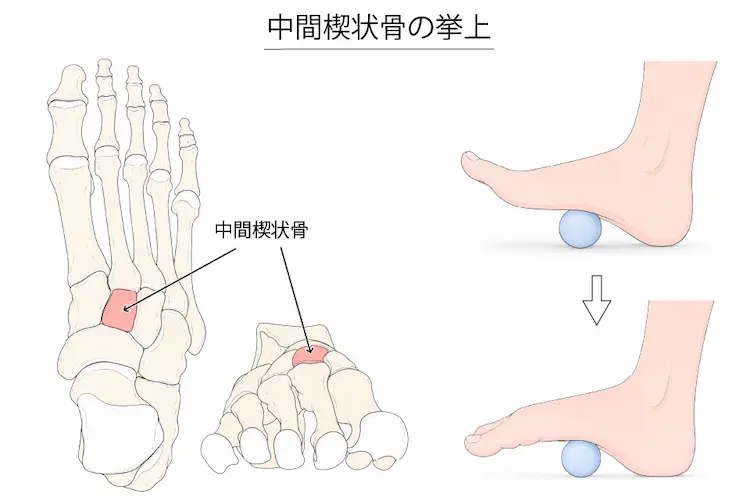 中間楔状骨の挙上２