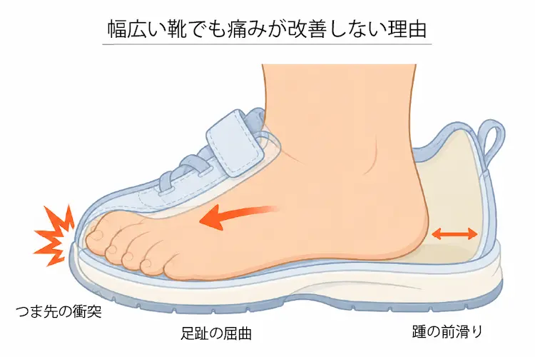 幅広い靴でも痛みが改善しない理由