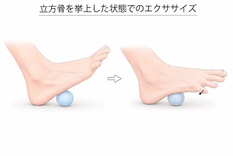 立方骨を挙上した状態でのエクササイズ