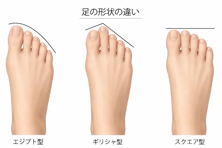 足の形状の違い
