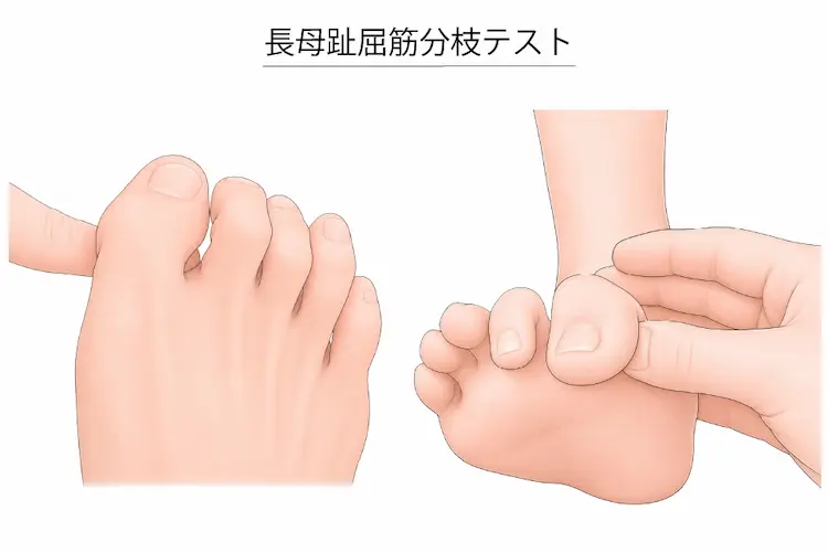 長母趾屈筋分枝テスト
