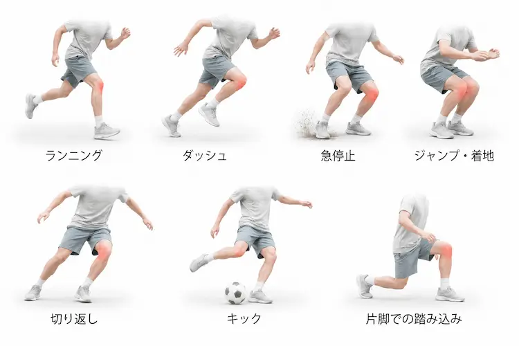 スポーツにおいて鵞足炎が起きやすい動作ランニングダッシュ急停止ジャンプ・着地切り返しキック片脚での踏み込みを説明したイラスト