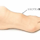 足の甲の痛み「リスフラン関節症」とは｜原因・症状・治療を解説