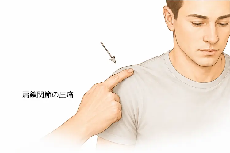 肩鎖関節の圧痛
