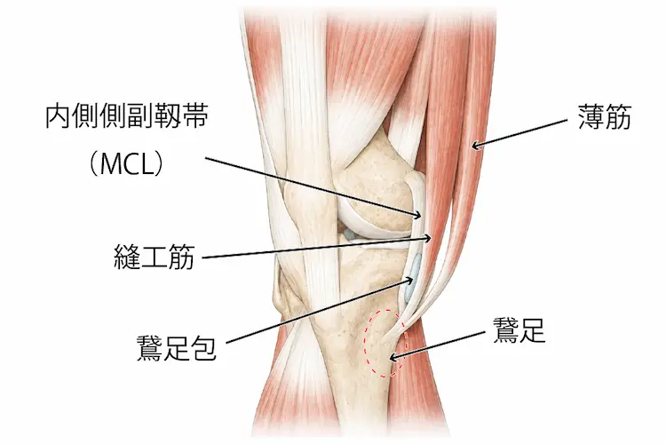 鵞足包の位置関係を図示したイラストMCLと縫工筋の間に鵞足包は存在する