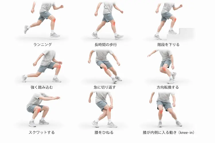 鵞足炎で痛みが出る9つの動作のイラスト