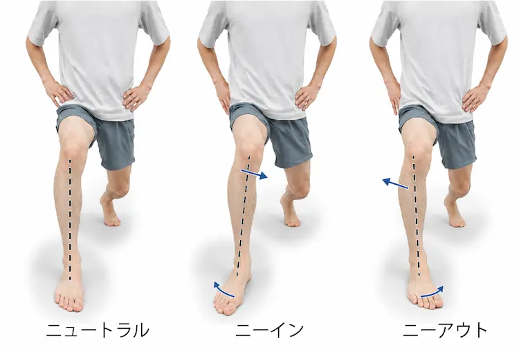ニュートラルのランジ、ニーインでのランジ、ニーアウトでのランジの３種類のポジションで痛みの変化を比較している様子