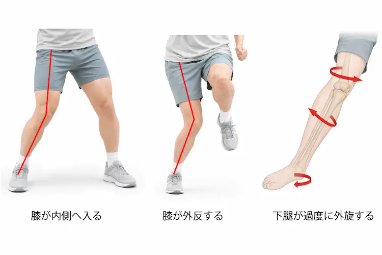 鵞足炎で痛くなる動作を説明したイラスト膝が内側へ入る膝が外反する下腿が過度に外旋する様子を図示している