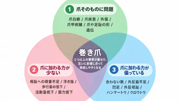 巻き爪の原因は？靴・歩き方・足の形から専門家が詳しく解説