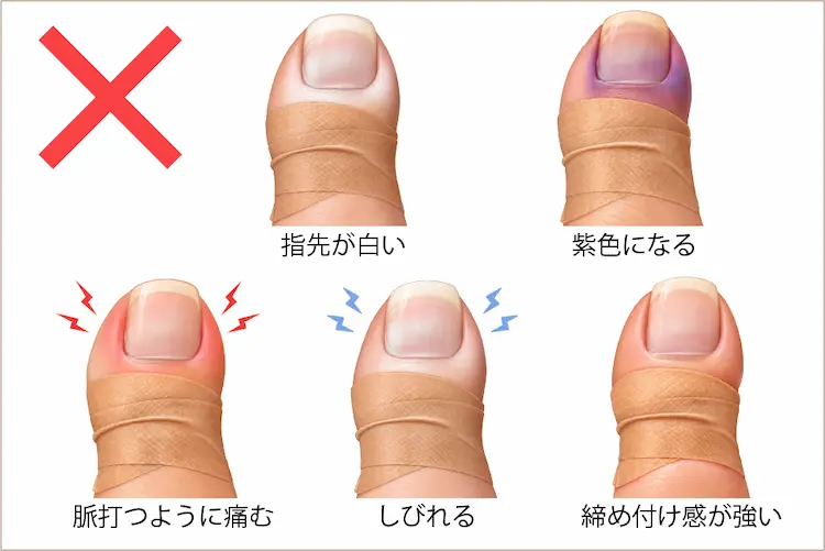テープをして指先が白くなる、紫色になる、しびれる、脈打つように痛む、締め付け感が強い様子